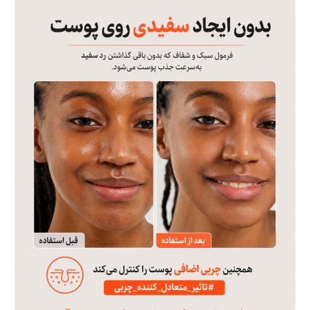 بدون رد سفیدی ضد افتاب کوزارکس