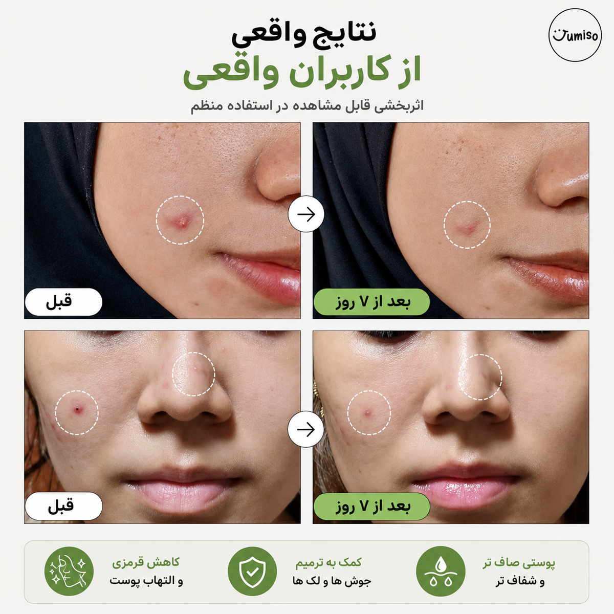 نتیجه استفاده از اسنس موسین حلزون و پپتاید جومیسو