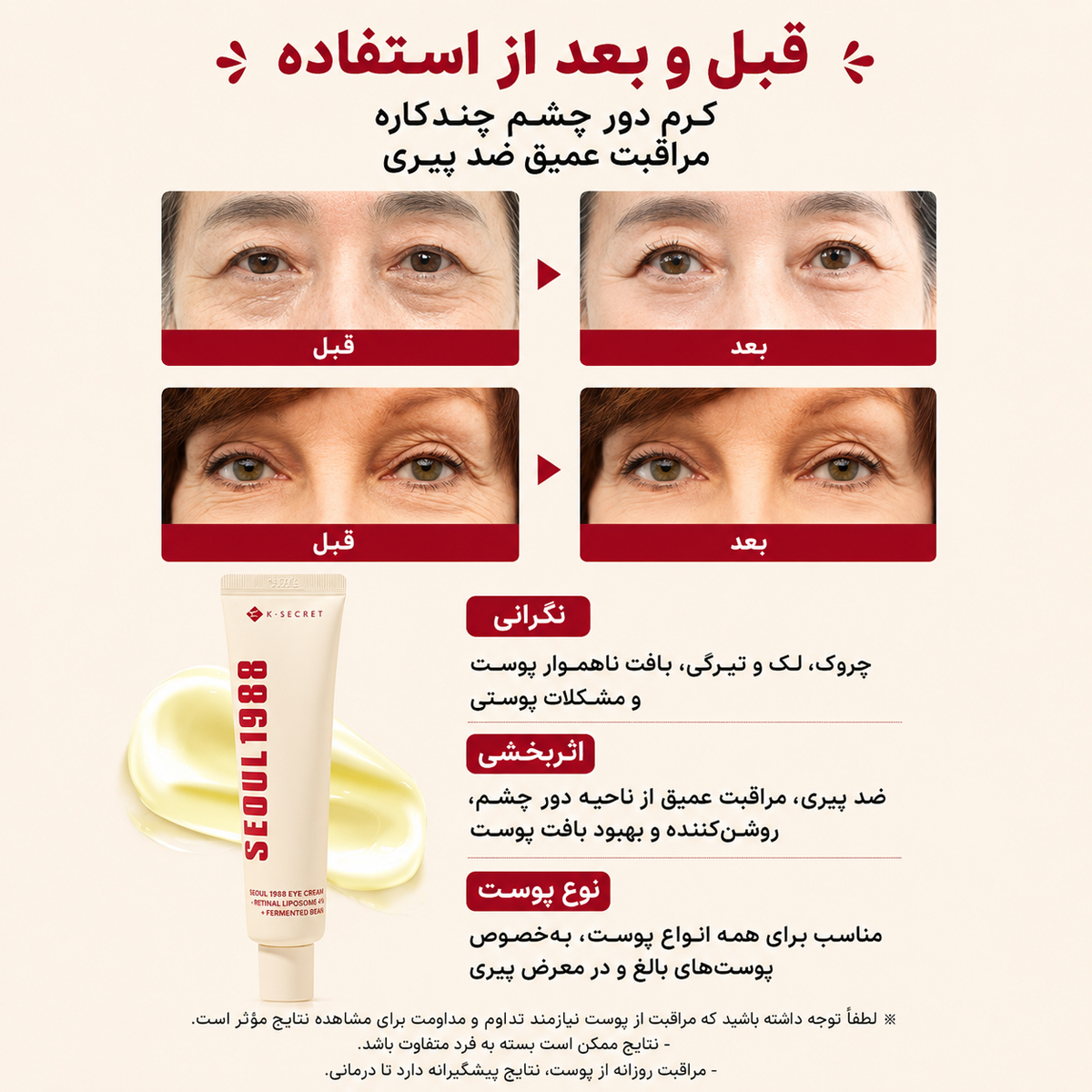 کرم دور چشم رتینال ۴٪ لوبیای تخمیر شده سئول ۱۹۸۸ کی سکرت - Image 5