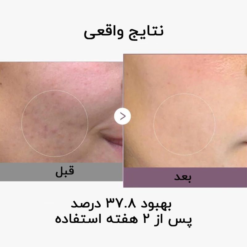 کرم کپسولی روشن کننده و ضد لک ویتامین C مدی کیوب 28 کرم کپسولی ویتامین سی مدیکیوب