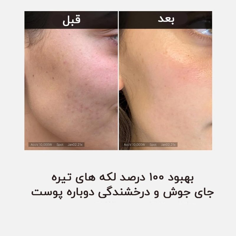 آمپول ویتامین C و روشن کننده پرو مدی کیوب 4 نتایج استفاده از سرم ویتامین سی مدیکیوب