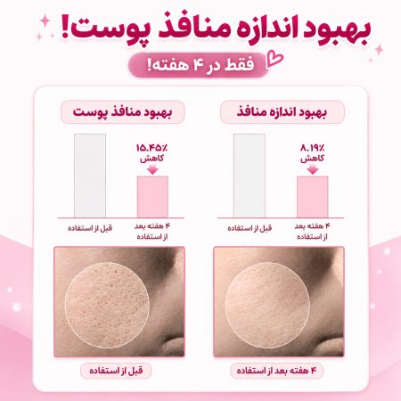 نتیجه استفاده تونر کنترل منافذ سنتلا اسکین 1004