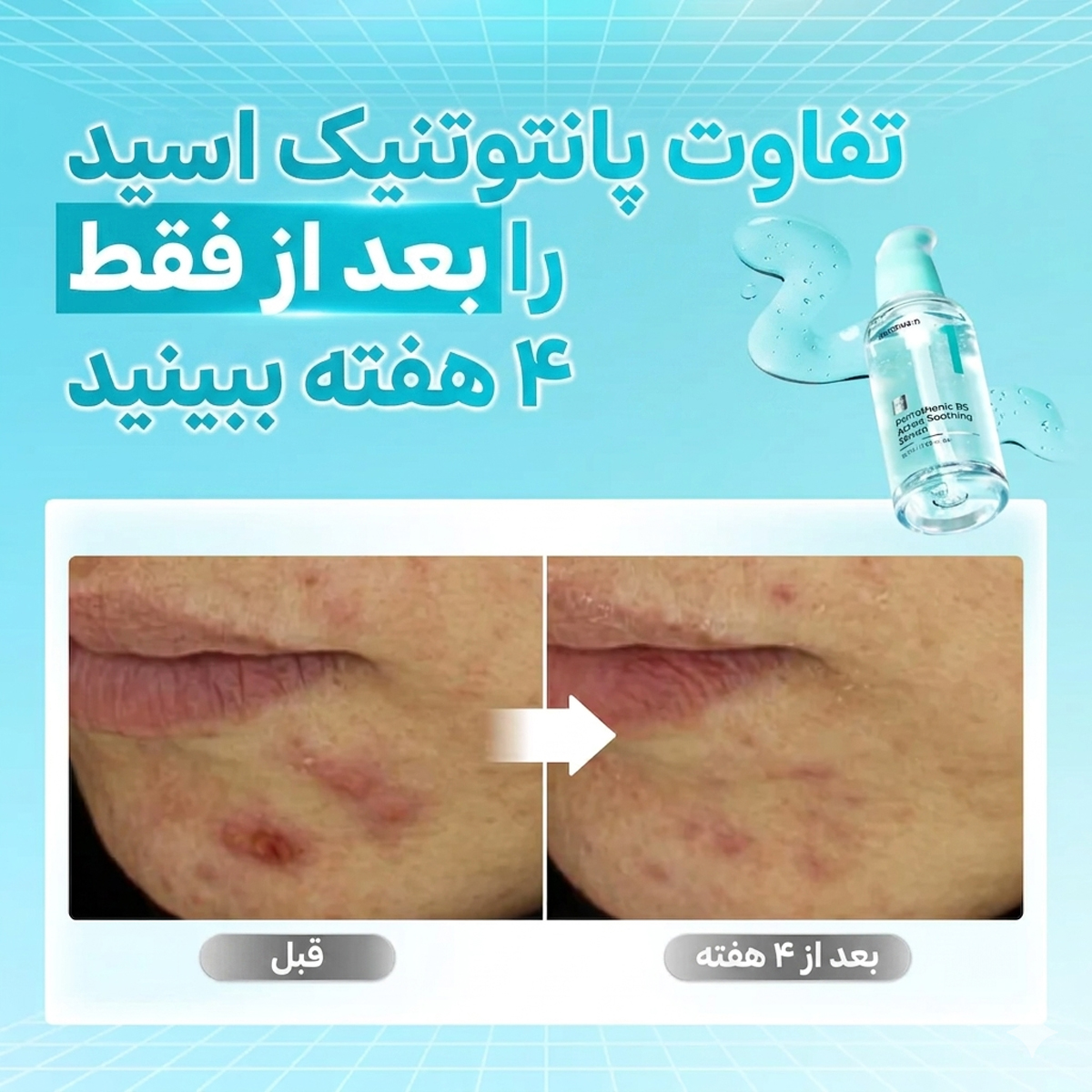 سرم تسکین دهنده و آبرسان پانتنول شماره ۱ نامبوزین 4 نتایج استفاده از سرم نامبوزین