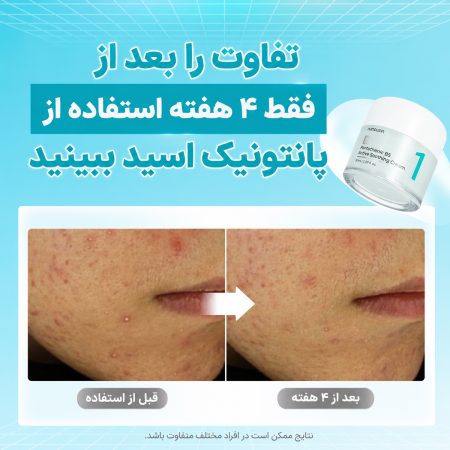 کرم پانتونیک اسید نامبوزین