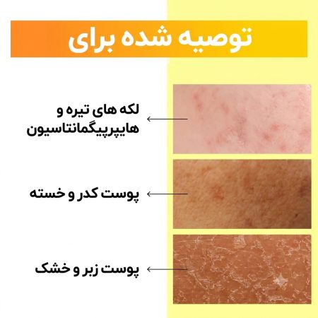 تونر نامبوزین برای پوست های
