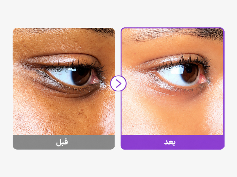 کرم دور چشم ضد چروک و روشن کننده رتینول NAD+ نامبوزین 17 نتیجه استفاده دور چشم نامبوزین