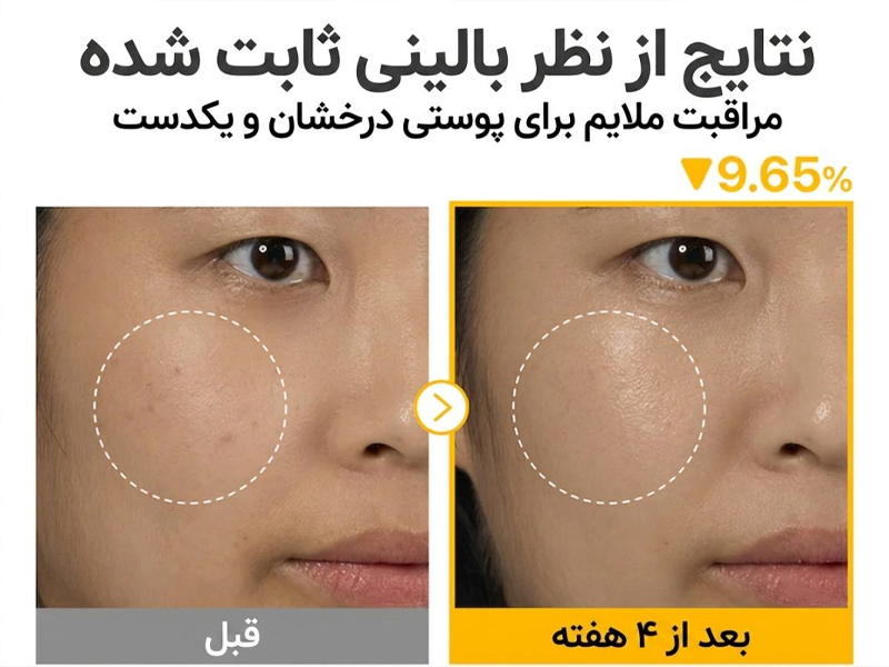 نتیجه استفاده سرم نامبوزین