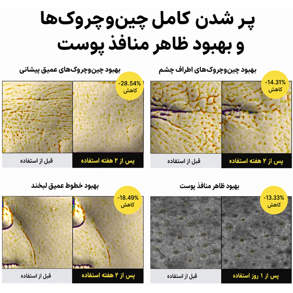 بوستر ضد چروک و جوانساز رتینال شات سلیمکس - Image 8