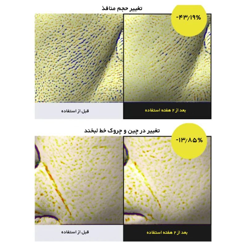 نتیجه استفاده از سلیمکس