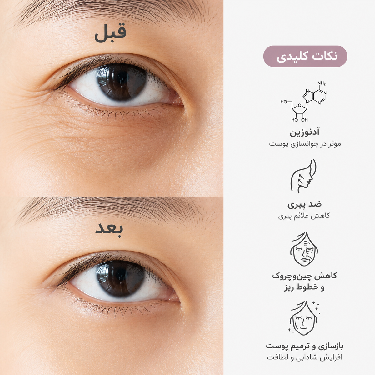 سرم دور چشم ضد چروک و روشن کننده دکتر التیا 4 نتیجه استفاده از سرم دور چشم ضد چروک و روشن کننده دکتر آلتیا