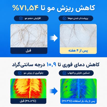 نتیجه استفاده سرم مو تقویت کننده و ضد ریزش سی پوری