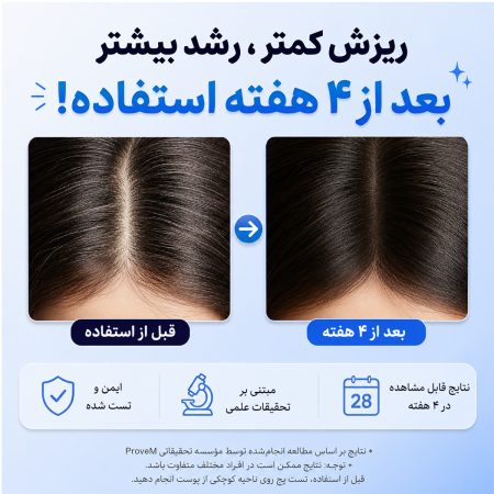 نتیجه کلینیکال سرم مو تقویت کننده و ضد ریزش سی پوری