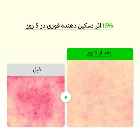 قبل و بعد استفاده از سرم اکوال بری