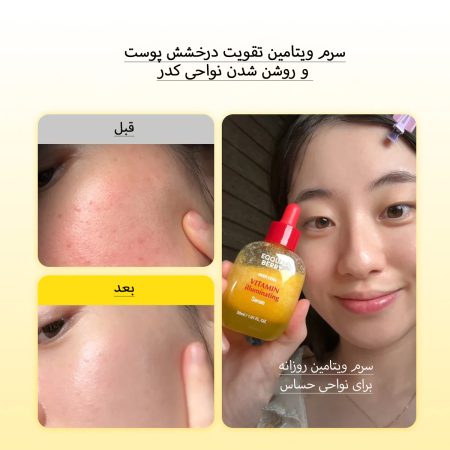 قبل و بعد استفاده از سرم اکوال بری