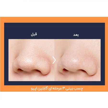 قبل و بعد استفاده