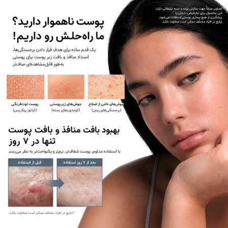 Glycolic Acid Booster Results