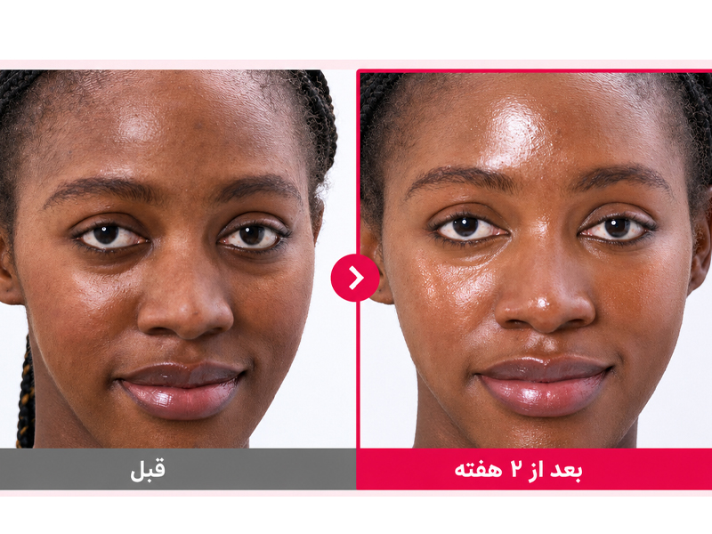 نتایج استفاده از سرم رز PDRN کلاژن 2X نامبوزین