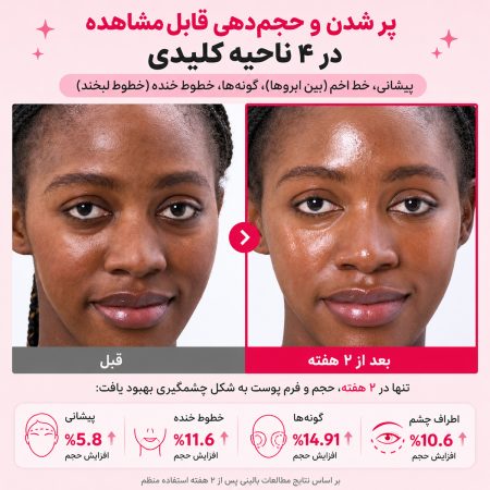 numbuzin no2 rose pdrn collagen 2x plumping serum results