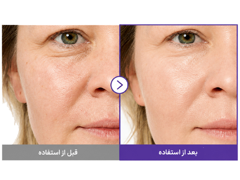 نتایج استفاده از کرم دور چشم نومبوزین شماره 9