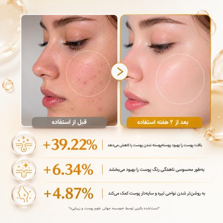 قبل و بعد تونر روشن‌کننده کوجیک اسید مدی‌ کیوب