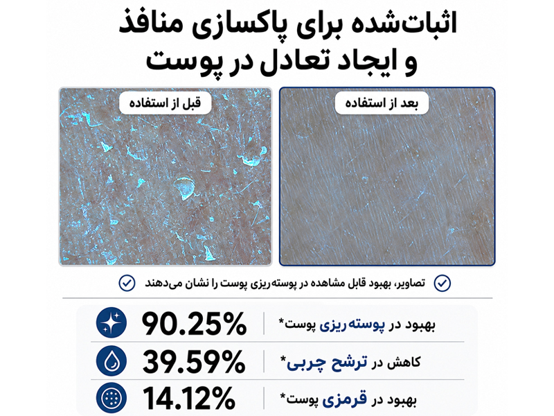 قبل و بعد از استفاده از بوستر گلیکولیک اسید آرنسیا