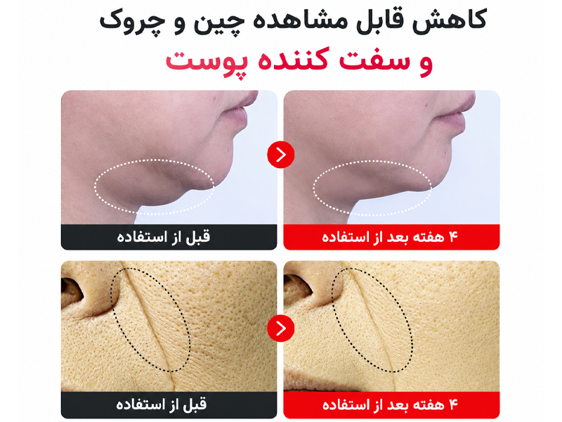 نتیجه استفاده از کرم مادکا تایم ریورس سنتلیان 24