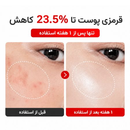 نتیجه استفاده کرم مادکا تایم ریورس سنتلیان 24