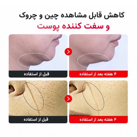 centellian24 madeca cream time reverse clinical result