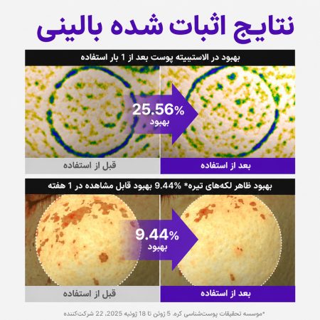 centellian24 pdrn before after
