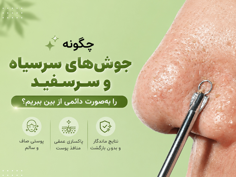 راه درمان جوش های سرسیاه