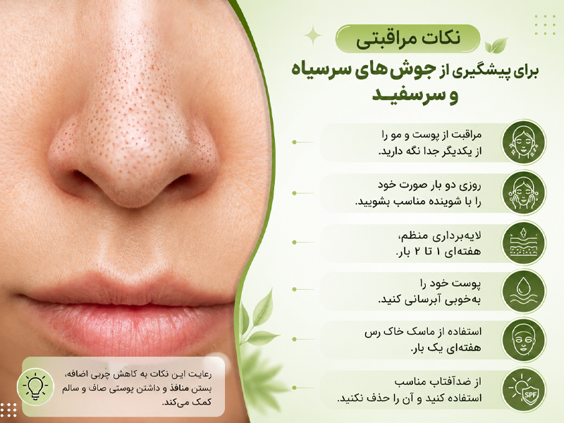 نکات مراقبتی