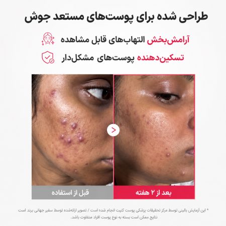 medicube hypochlorous acid daily facial spray before after