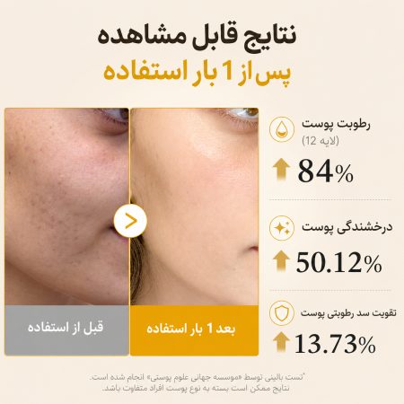 نتیجه استفاده از میست سرم روشن‌ کننده کوجیک اسید مدی کیوب