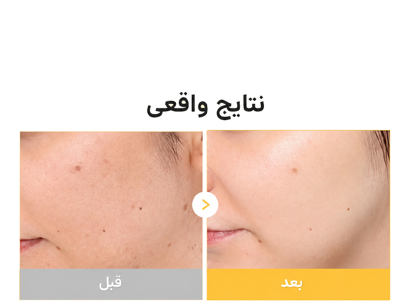 ماسک ژلی روشن کننده کوجیک اسید و زردچوبه مدی کیوب 16 نتایج کلینیکال