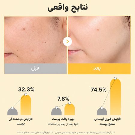 ماسک ژلی روشن کننده کوجیک اسید و زردچوبه مدی کیوب 13 نتیجه استفاده از ماسک ژلی روشن کننده کوجیک اسید و زردچوبه مدی کیوب