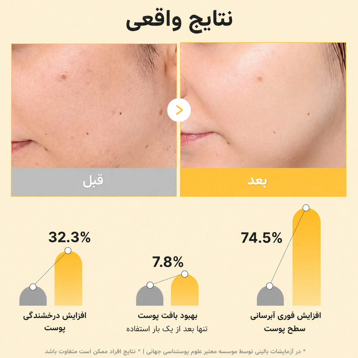 ماسک ژلی روشن کننده کوجیک اسید و زردچوبه مدی کیوب 7 نتیجه استفاده از ماسک ژلی روشن کننده کوجیک اسید و زردچوبه مدی کیوب