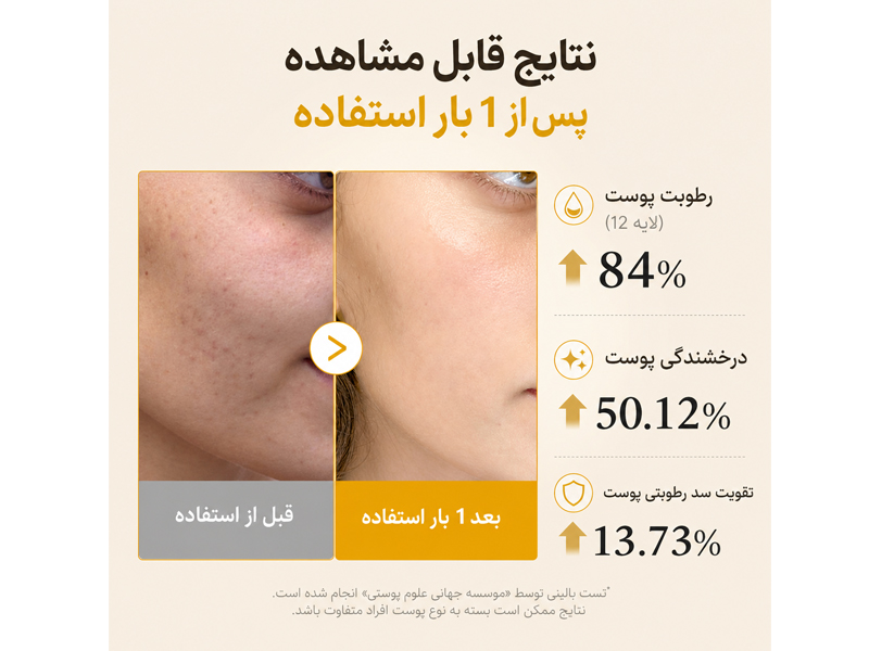 نتیجه استفاده از میست سرم روشن‌کننده کوجیک اسید مدی کیوب