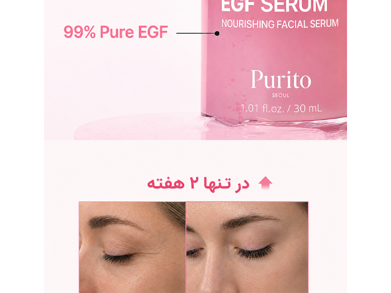 قبل و بعد سرم جوانساز مولتی PDRN کلاژن و EGF پوریتو
