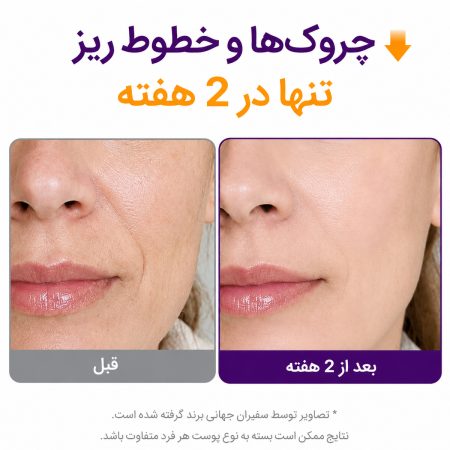 قبل و بعد استفاده از سرم ضدچروک رتینول رتینال +NAD 2000 پوریتو 