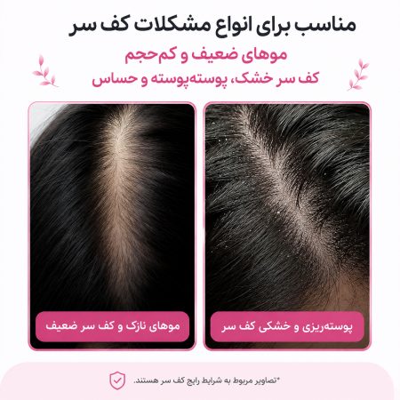 medicube rosemary pdrn scalp serum suitable for